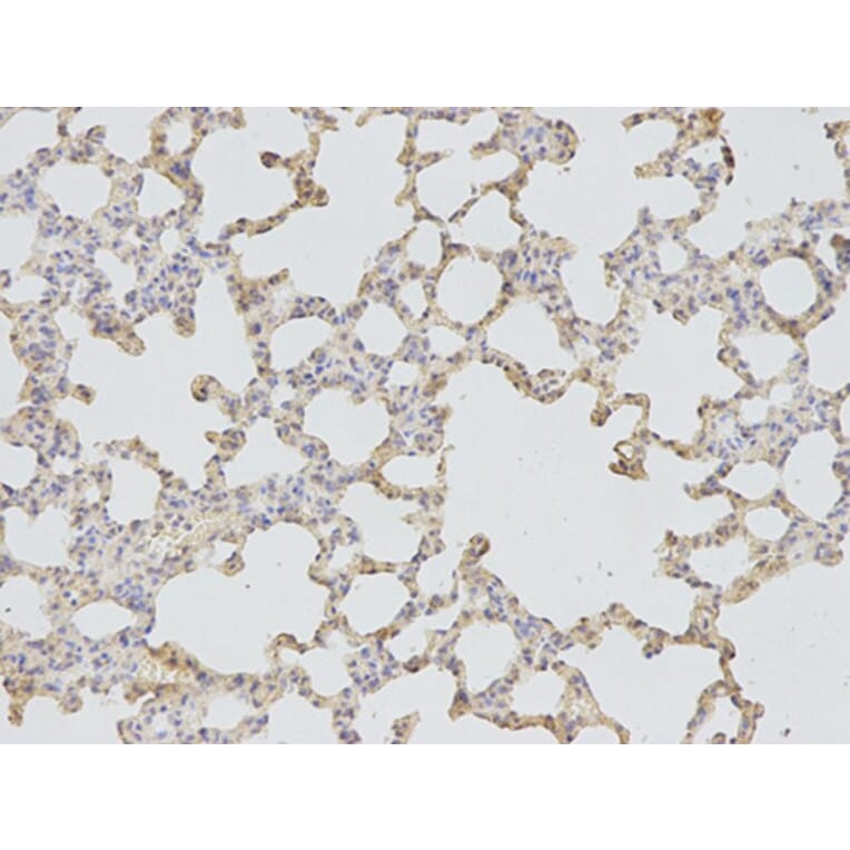 Immunohistochemistry - CD46 Antibody from Signalway Antibody (32368) - Antibodies.com