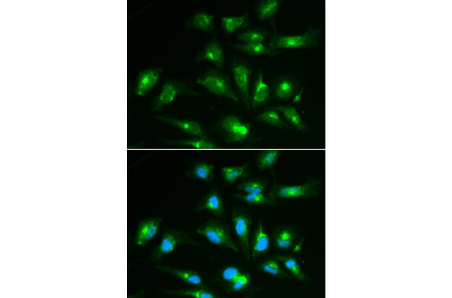 Immunofluorescence - CD46 Antibody from Signalway Antibody (32368) - Antibodies.com