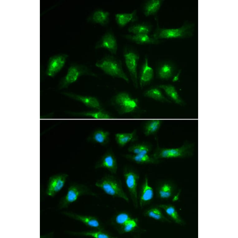 Immunofluorescence - CD46 Antibody from Signalway Antibody (32368) - Antibodies.com