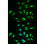 Immunofluorescence - CD46 Antibody from Signalway Antibody (32368) - Antibodies.com