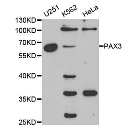 Western blot - PAX3 Antibody from Signalway Antibody (32380) - Antibodies.com