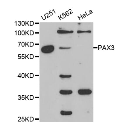 Western blot - PAX3 Antibody from Signalway Antibody (32380) - Antibodies.com