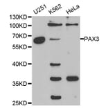 Western blot - PAX3 Antibody from Signalway Antibody (32380) - Antibodies.com