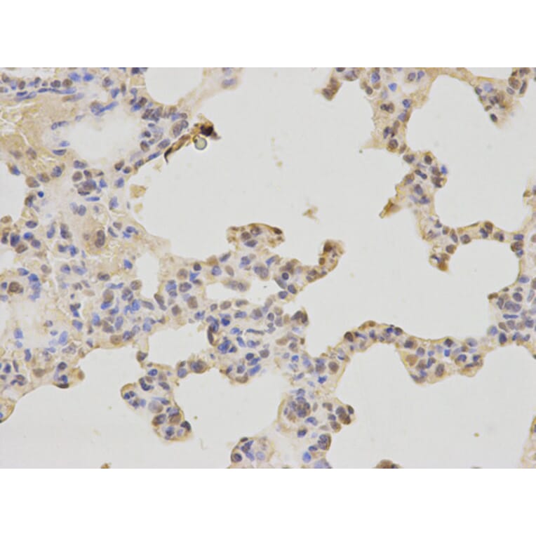 Immunohistochemistry - PAX3 Antibody from Signalway Antibody (32380) - Antibodies.com