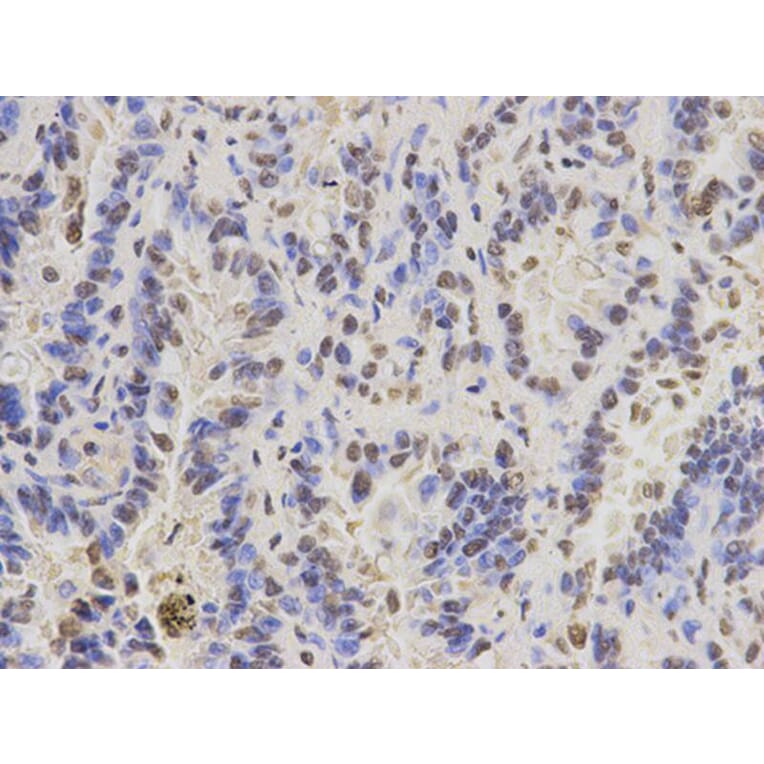 Immunohistochemistry - PAX3 Antibody from Signalway Antibody (32380) - Antibodies.com