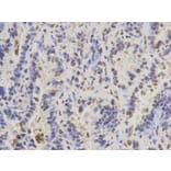 Immunohistochemistry - PAX3 Antibody from Signalway Antibody (32380) - Antibodies.com