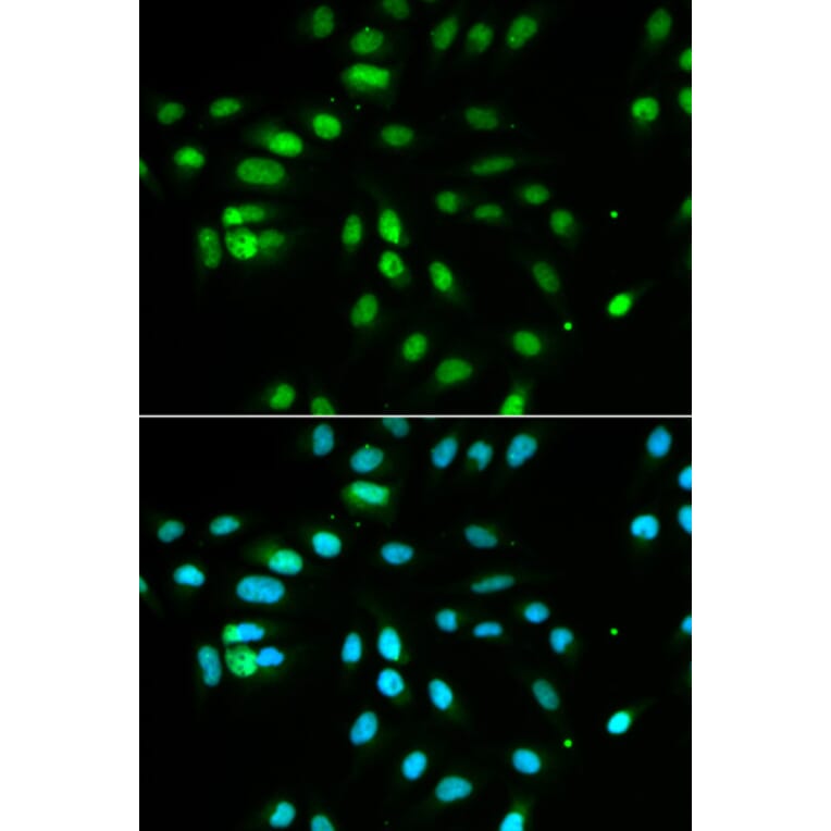 Immunofluorescence - PAX3 Antibody from Signalway Antibody (32380) - Antibodies.com