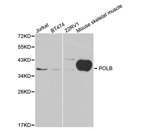 Western blot - POLB Antibody from Signalway Antibody (32383) - Antibodies.com