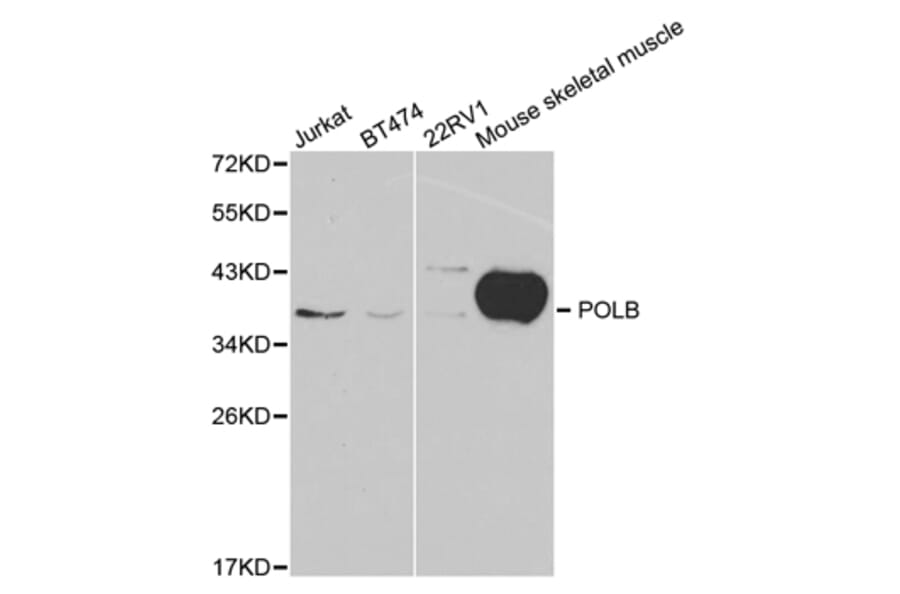 Western blot - POLB Antibody from Signalway Antibody (32383) - Antibodies.com
