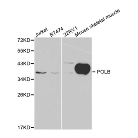 Western blot - POLB Antibody from Signalway Antibody (32383) - Antibodies.com