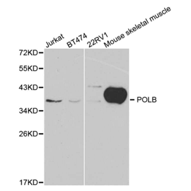 Western blot - POLB Antibody from Signalway Antibody (32383) - Antibodies.com