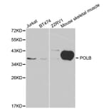 Western blot - POLB Antibody from Signalway Antibody (32383) - Antibodies.com
