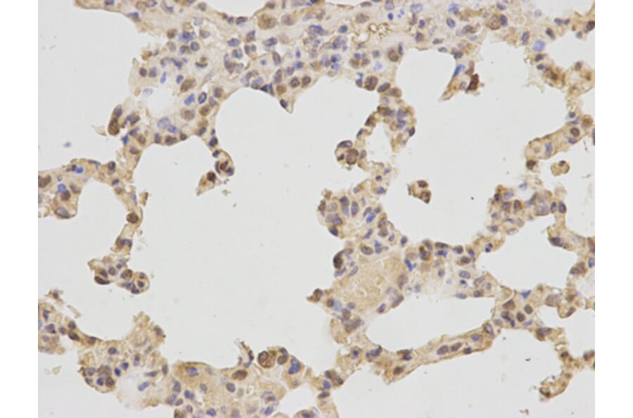 Immunohistochemistry - POLB Antibody from Signalway Antibody (32383) - Antibodies.com