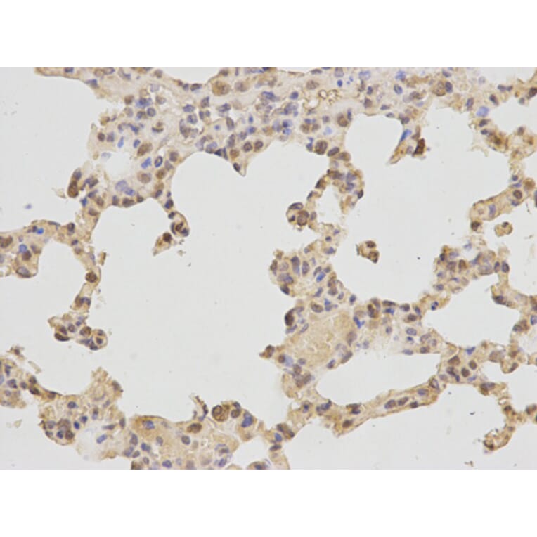 Immunohistochemistry - POLB Antibody from Signalway Antibody (32383) - Antibodies.com