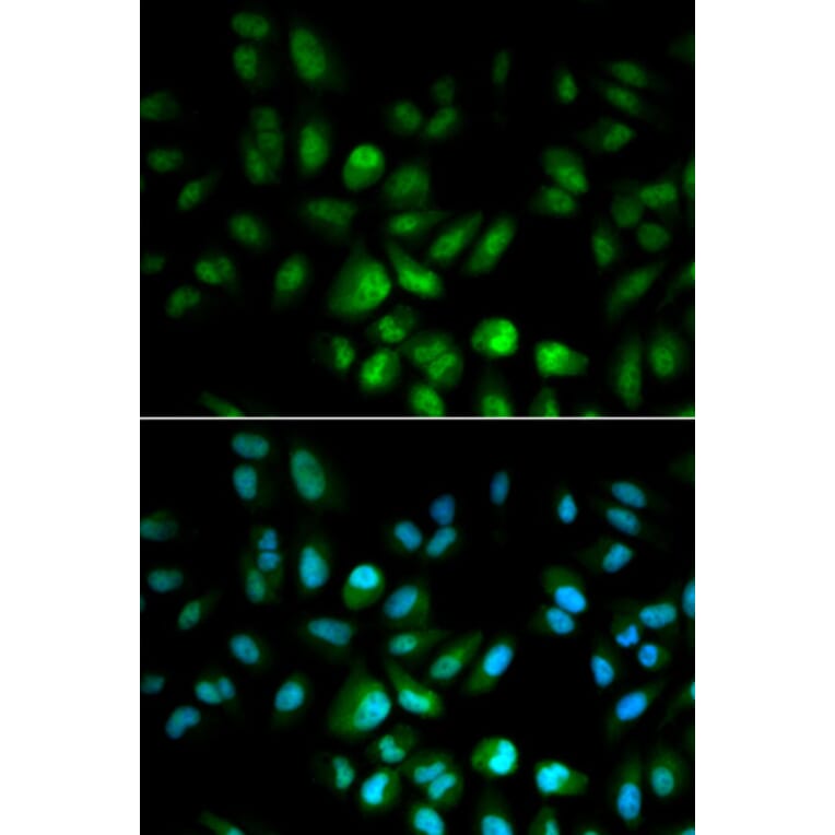 Immunofluorescence - USF1 Antibody from Signalway Antibody (32414) - Antibodies.com