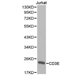 Western blot - CD3E Antibody from Signalway Antibody (32416) - Antibodies.com
