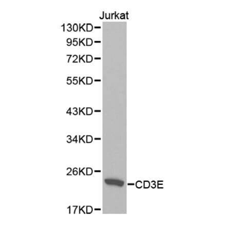 Western blot - CD3E Antibody from Signalway Antibody (32416) - Antibodies.com