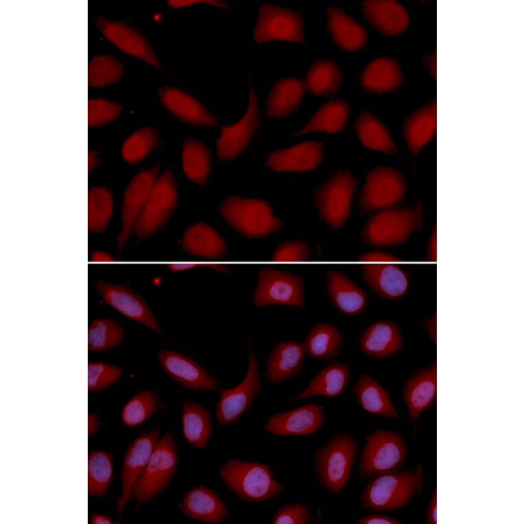 Immunofluorescence - CD3E Antibody from Signalway Antibody (32416) - Antibodies.com