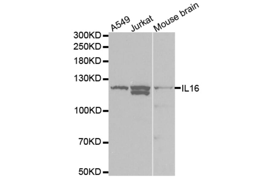 Western blot - IL16 Antibody from Signalway Antibody (32422) - Antibodies.com