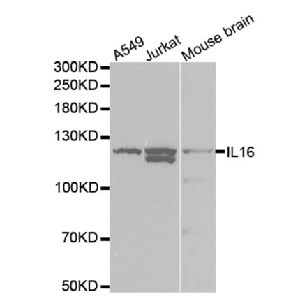 Western blot - IL16 Antibody from Signalway Antibody (32422) - Antibodies.com