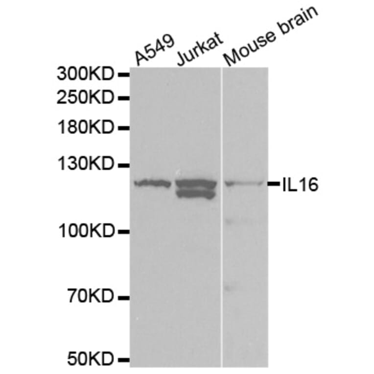 Western blot - IL16 Antibody from Signalway Antibody (32422) - Antibodies.com