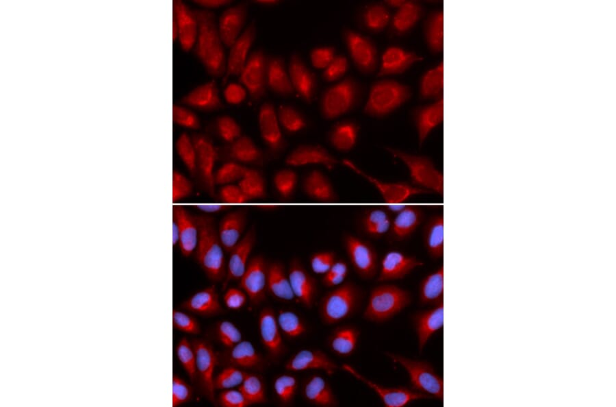Immunofluorescence - IL16 Antibody from Signalway Antibody (32422) - Antibodies.com