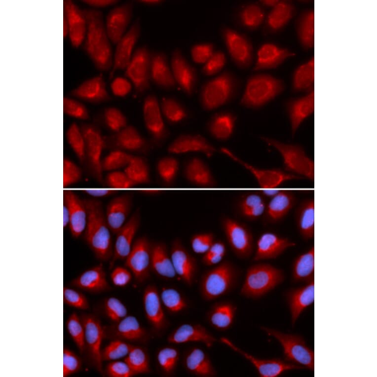 Immunofluorescence - IL16 Antibody from Signalway Antibody (32422) - Antibodies.com