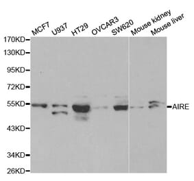 Western blot - AIRE Antibody from Signalway Antibody (32424) - Antibodies.com