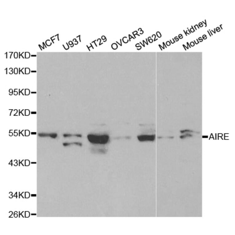 Western blot - AIRE Antibody from Signalway Antibody (32424) - Antibodies.com