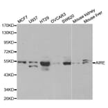 Western blot - AIRE Antibody from Signalway Antibody (32424) - Antibodies.com