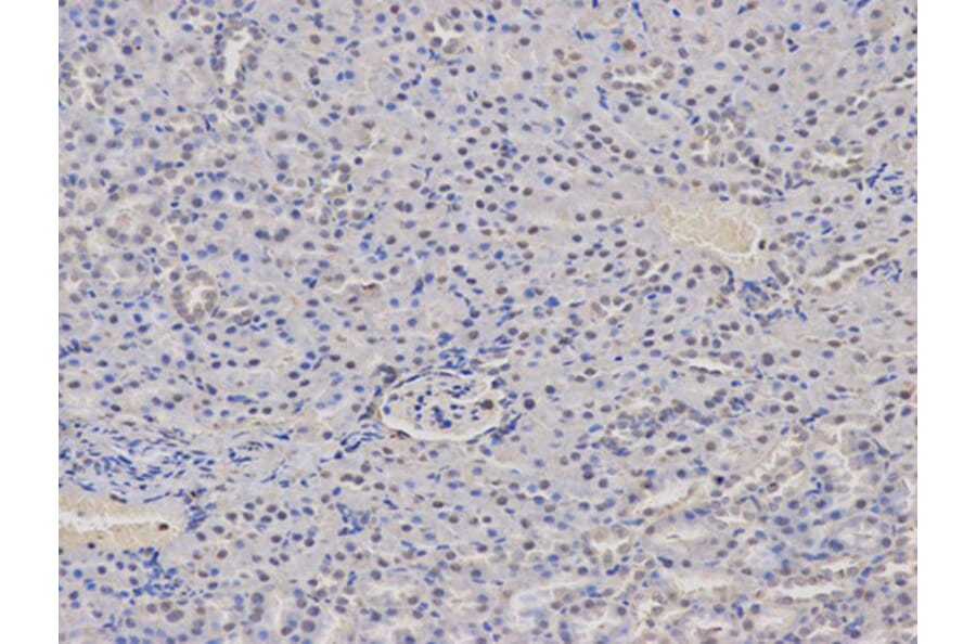 Immunohistochemistry - AIRE Antibody from Signalway Antibody (32424) - Antibodies.com