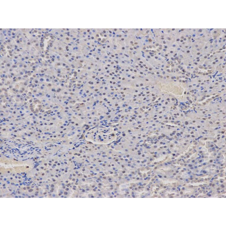 Immunohistochemistry - AIRE Antibody from Signalway Antibody (32424) - Antibodies.com