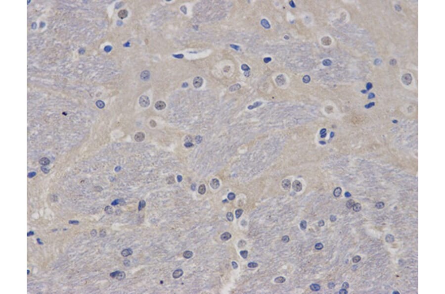 Immunohistochemistry - AIRE Antibody from Signalway Antibody (32424) - Antibodies.com