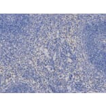 Immunohistochemistry - AIRE Antibody from Signalway Antibody (32424) - Antibodies.com