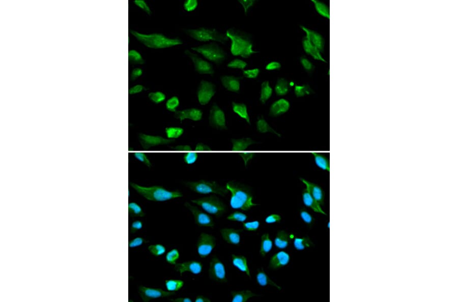 Immunofluorescence - AIRE Antibody from Signalway Antibody (32424) - Antibodies.com