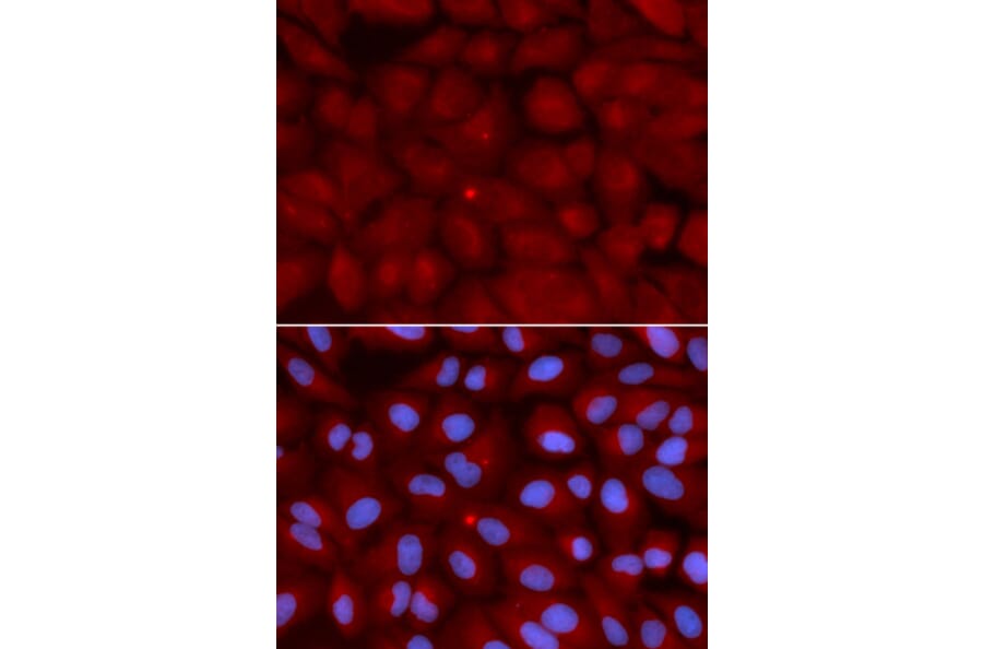 Immunofluorescence - BIN1 Antibody from Signalway Antibody (32436) - Antibodies.com