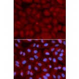 Immunofluorescence - BIN1 Antibody from Signalway Antibody (32436) - Antibodies.com