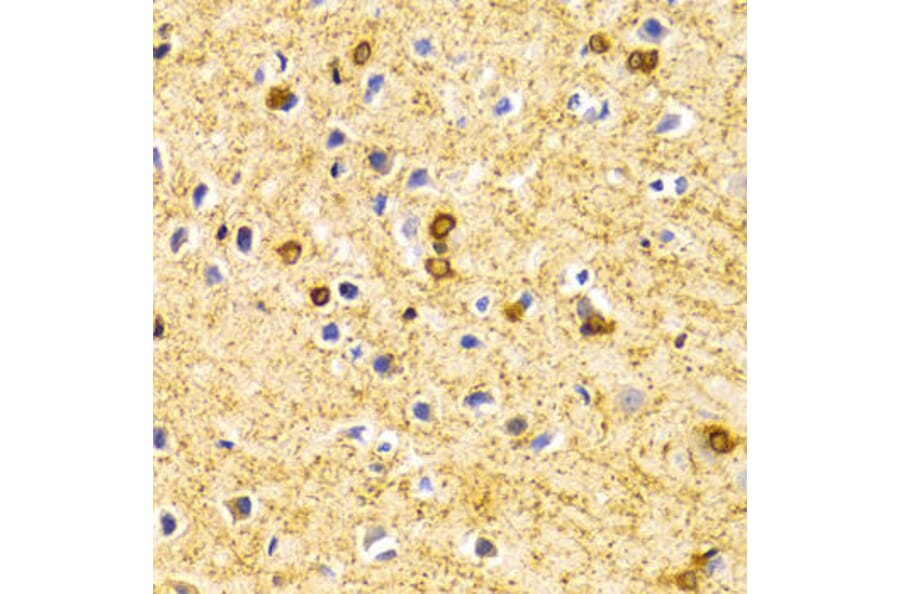 Immunohistochemistry - BIN1 Antibody from Signalway Antibody (32436) - Antibodies.com