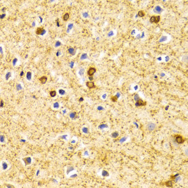 Immunohistochemistry - BIN1 Antibody from Signalway Antibody (32436) - Antibodies.com