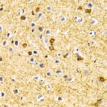 Immunohistochemistry - BIN1 Antibody from Signalway Antibody (32436) - Antibodies.com
