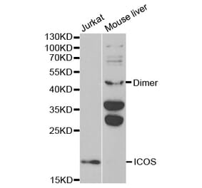 Western blot - ICOS Antibody from Signalway Antibody (32445) - Antibodies.com