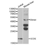 Western blot - ICOS Antibody from Signalway Antibody (32445) - Antibodies.com