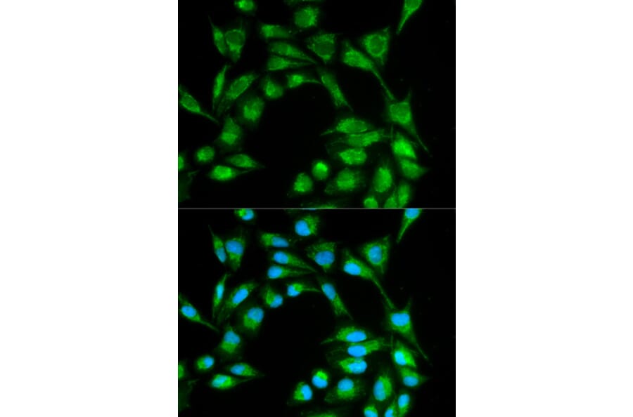 Immunofluorescence - ICOS Antibody from Signalway Antibody (32445) - Antibodies.com