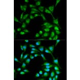 Immunofluorescence - ICOS Antibody from Signalway Antibody (32445) - Antibodies.com