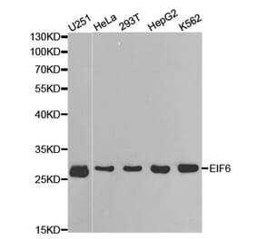 Western blot - EIF6 Antibody from Signalway Antibody (32448) - Antibodies.com