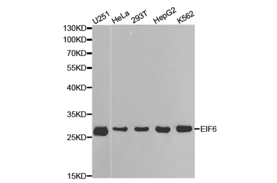Western blot - EIF6 Antibody from Signalway Antibody (32448) - Antibodies.com