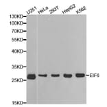 Western blot - EIF6 Antibody from Signalway Antibody (32448) - Antibodies.com