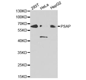 Western blot - PSAP Antibody from Signalway Antibody (32449) - Antibodies.com