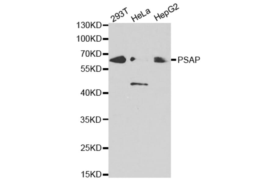 Western blot - PSAP Antibody from Signalway Antibody (32449) - Antibodies.com