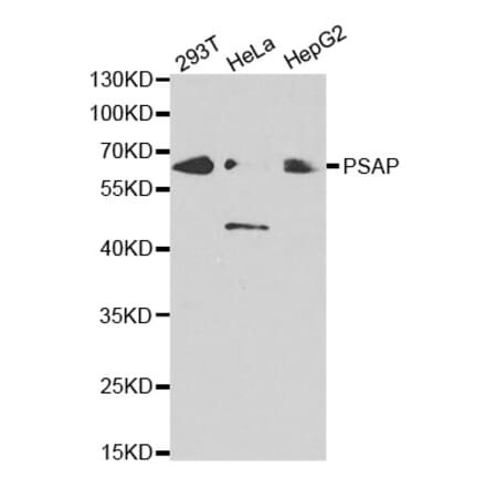Western blot - PSAP Antibody from Signalway Antibody (32449) - Antibodies.com